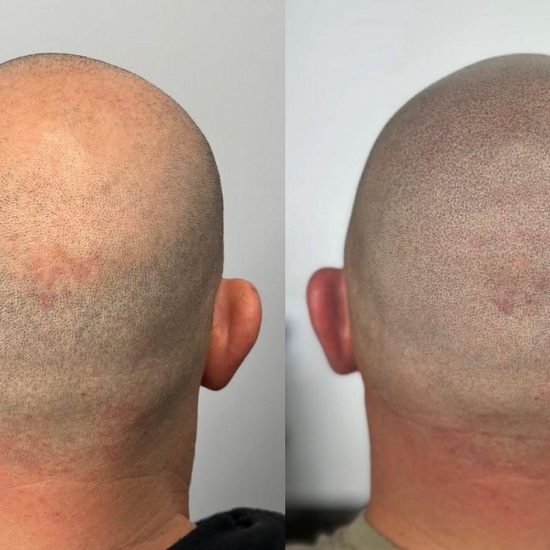 Shaved07